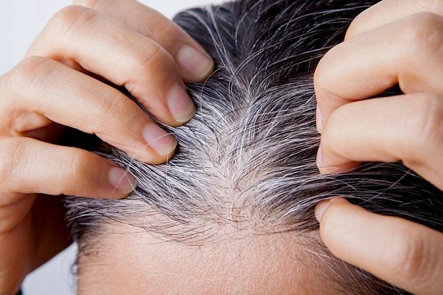 Saçların vaxtından əvvəl ağarmasının səbəbi tapıldı –