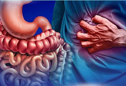 Bağırsaq xərçəngi riskini artıran kron xəstəliyinin müalicəsi