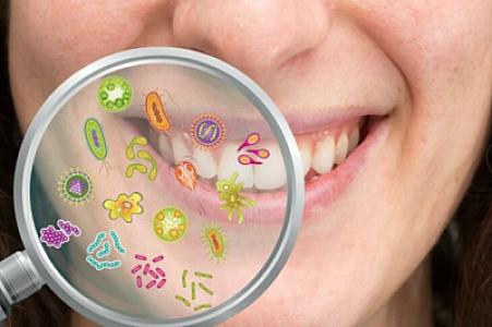Ağızdakı bakteriyalar bu xəstəliyin xəbərçisi ola bilər -