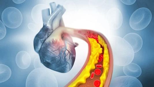 Əsl yaşınız damar yaşınızdır –