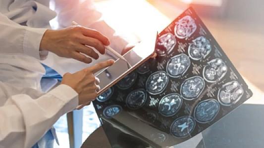 Beyin hüceyrələrini səssizcə öldürən xəstəlik: