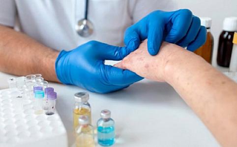 Səhiyyə Nazirliyi qızılcanın ən çox yoluxuculuq dövrünü açıqlayıb