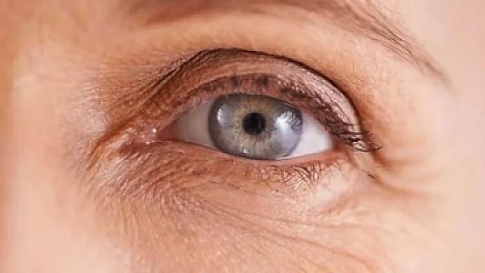 Göz qapağınız daim səyirir?
