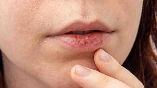 Dodaq rənginizə görə sahib olduğunuz xəstəliklər –