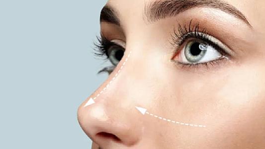 Burun estetikliyi modası