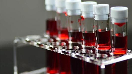 “Sabahdan başlayacağam” deyənlərin qan qrupu məlum oldu: