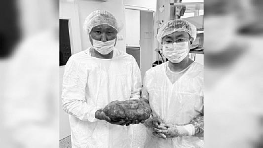 Xəstənin qarnından