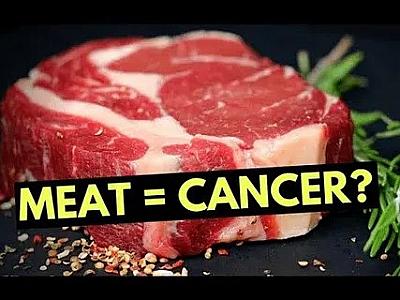 Bu qida bağırsaq xərçəngi yaradır -