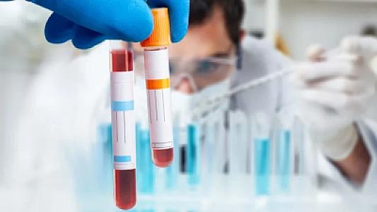 Xatırlamaq üçün yeni ümid: