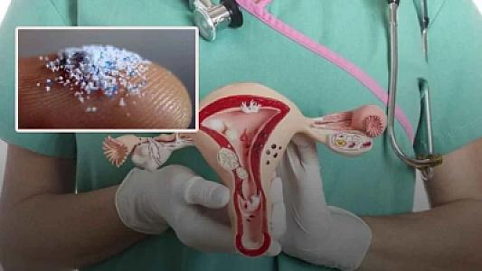 Qadın yumurtalıqlarından alınan mayenin tərkibində