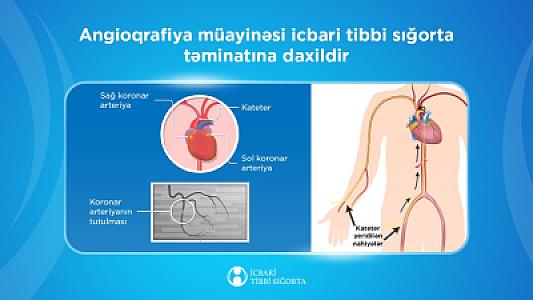 İcbari tibbi sığorta ilə 50 mindən artıq