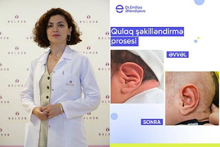 Azərbaycanda bir İLK!