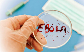 Alimlər ölümcül Ebola qızdırmasının müalicəsində